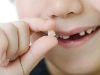 Trẻ mọc răng và thay răng cần lưu ý gì?
