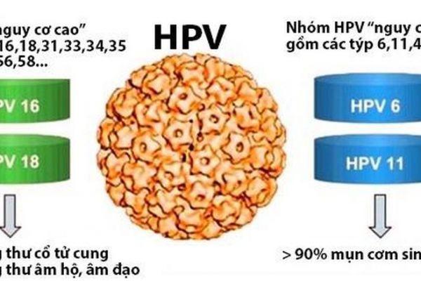 Đừng mắc ung thư cổ tử cung chỉ vì quan niệm sai lầm về phòng ngừa HPV